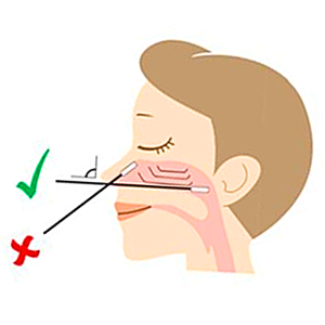 Come si prende il campione nasale